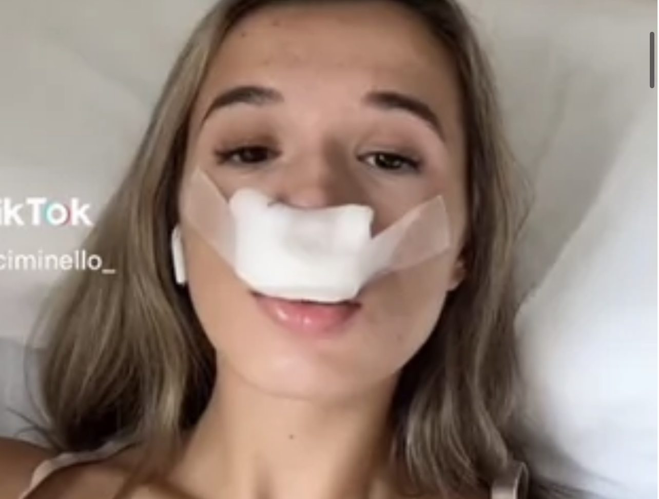 19 Letnia Tiktokerka Fiore Ciminello Zdecydowała Się Na Operację Plastyczną Nosa By Jej Dzieci 6064